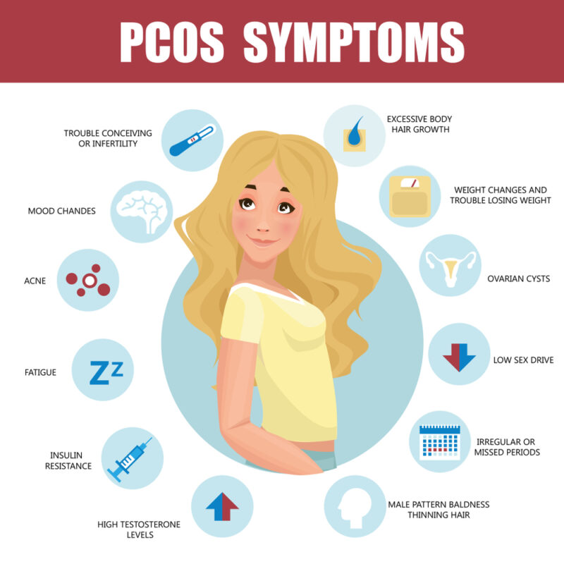 List of PCOS Symptoms